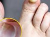 Health Expert Reveals Warning Signs of Two Silent Foot K.ill.ers and How To Spot Them
